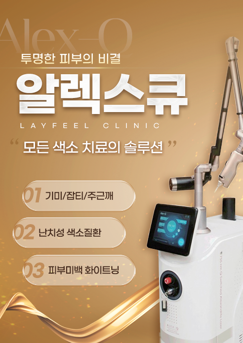 알렉스큐