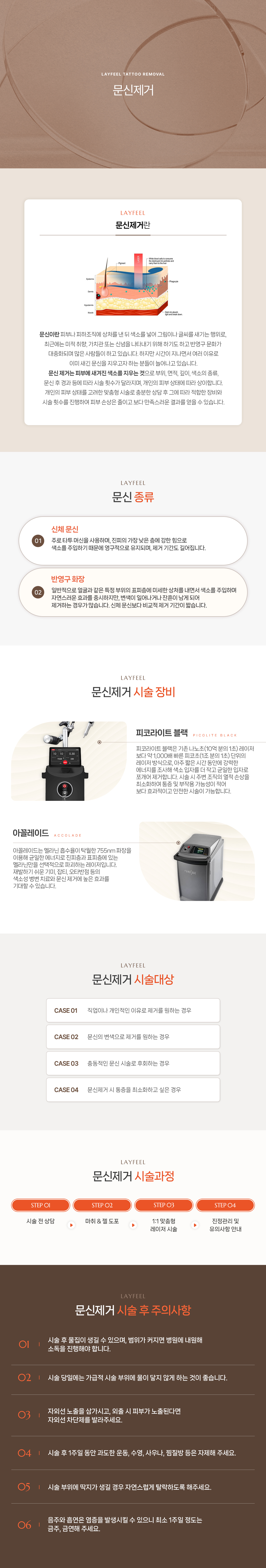 문신제거